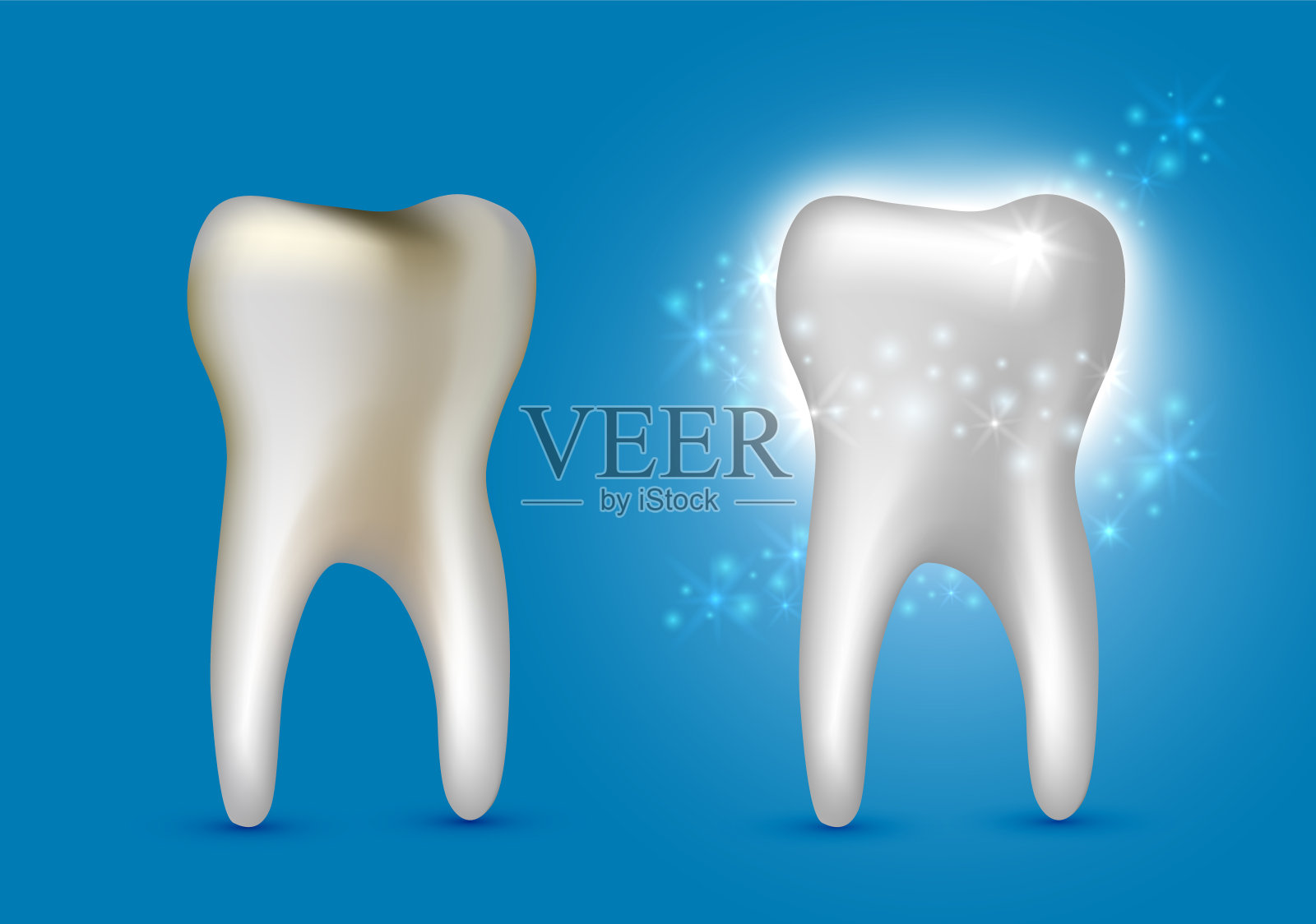 美丽逼真的牙医向量集龋齿和白色闪亮清洁牙齿在蓝色的背景。插画图片素材