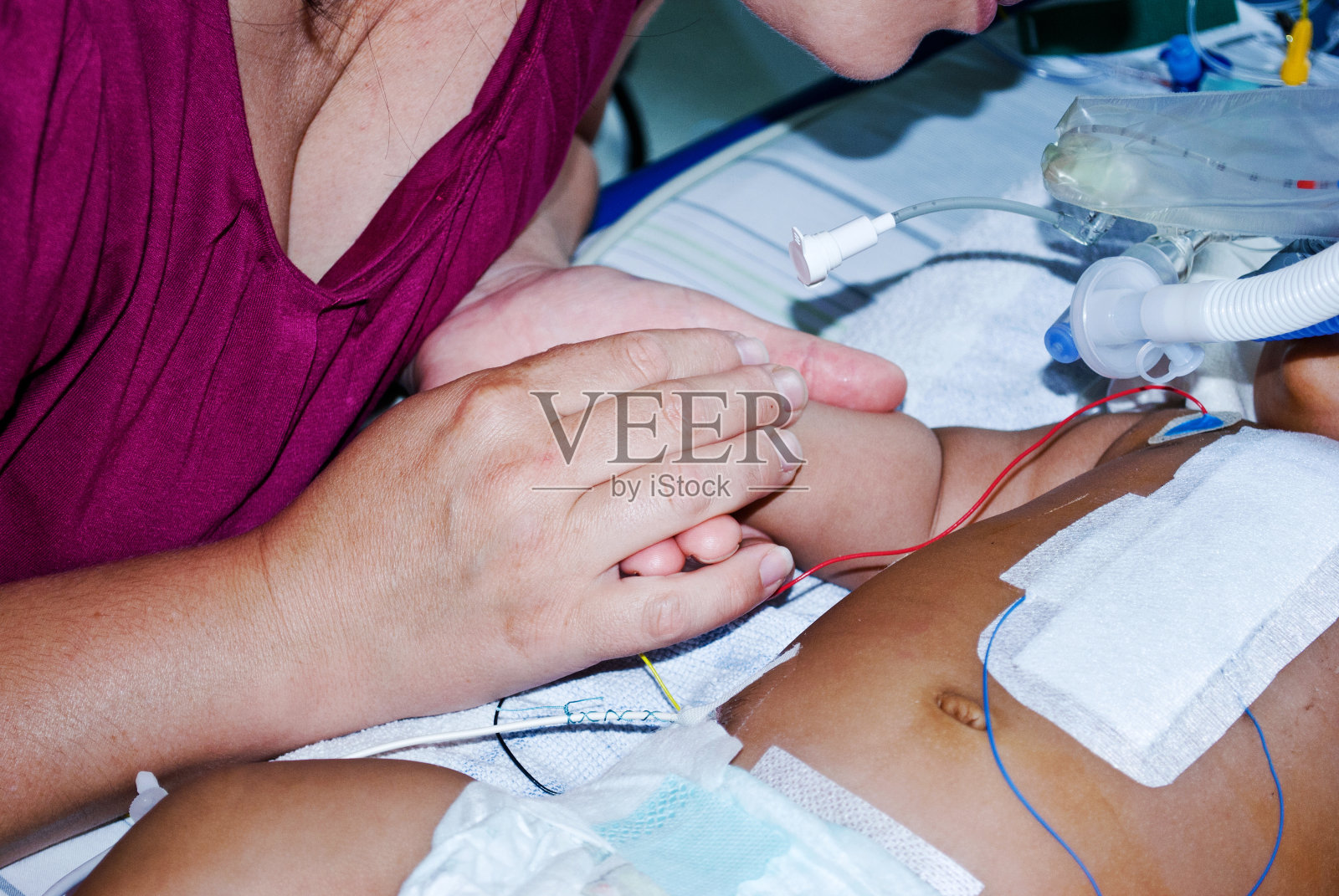 在医院的儿科重症监护病房，一位母亲用手安慰一个挂在呼吸机上的危重婴儿照片摄影图片