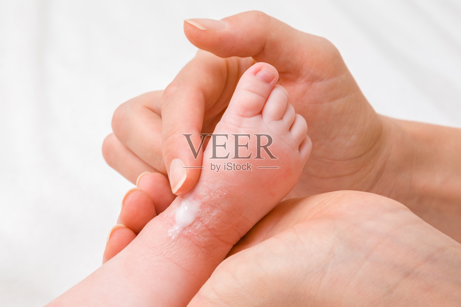 女人手牵着婴儿的腿。母亲仔细地涂抹药膏。因奶粉或其他食物导致皮肤发红干燥。关心宝宝的身体。特写镜头。照片摄影图片