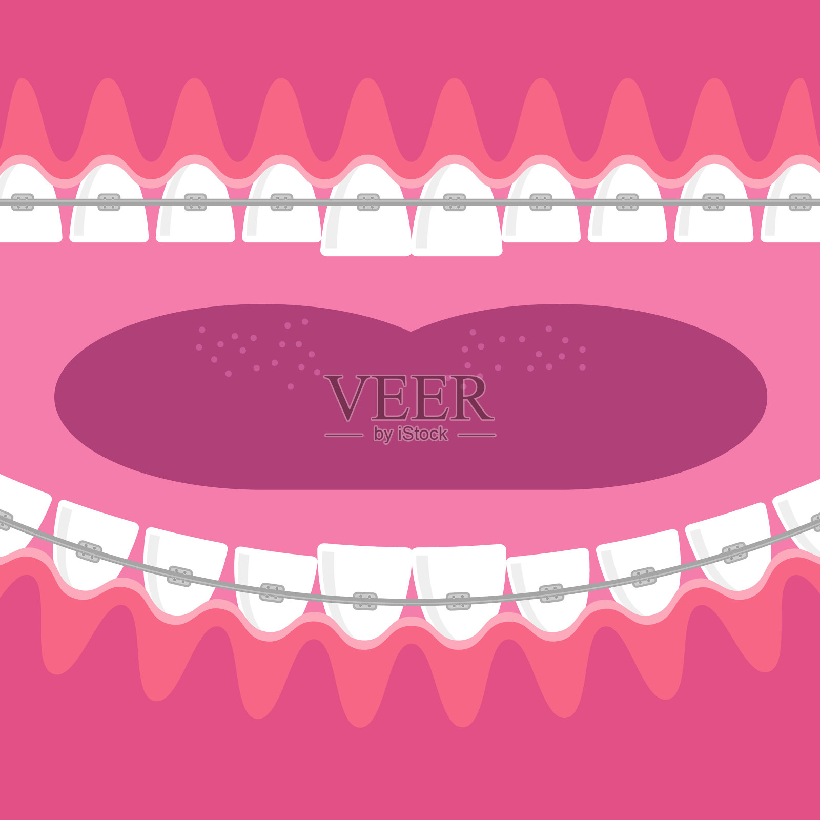 牙套，牙齿护理背景，牙齿矫正插画图片素材