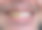 牙齿美白的概念。微笑的男人，黄牙，前后。素材图片